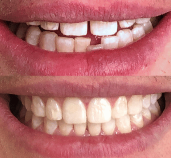Smile Gallery