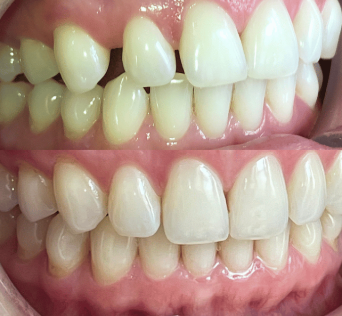 Smile Gallery