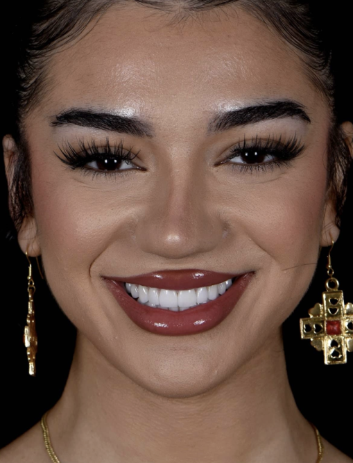 Before Image  - NG Smiles