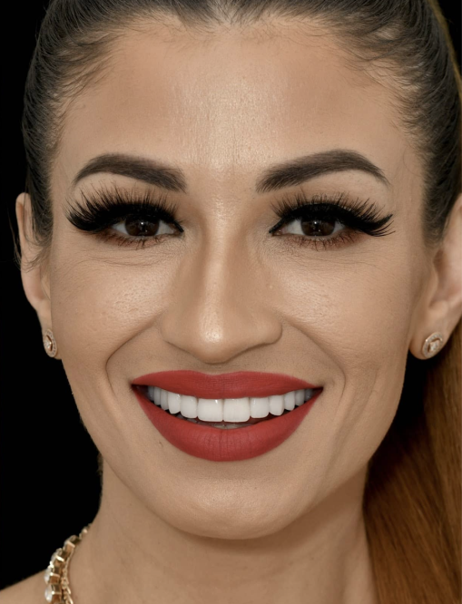 Before Image  - NG Smiles