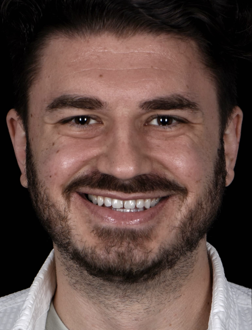 Before Image  - NG Smiles