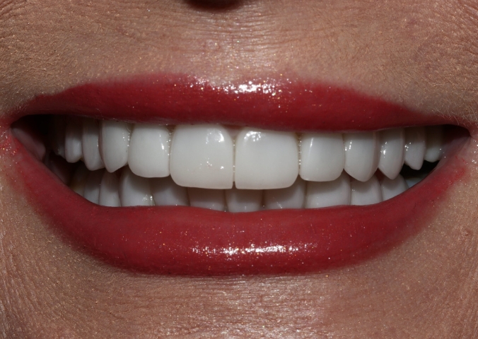 Case 2 after